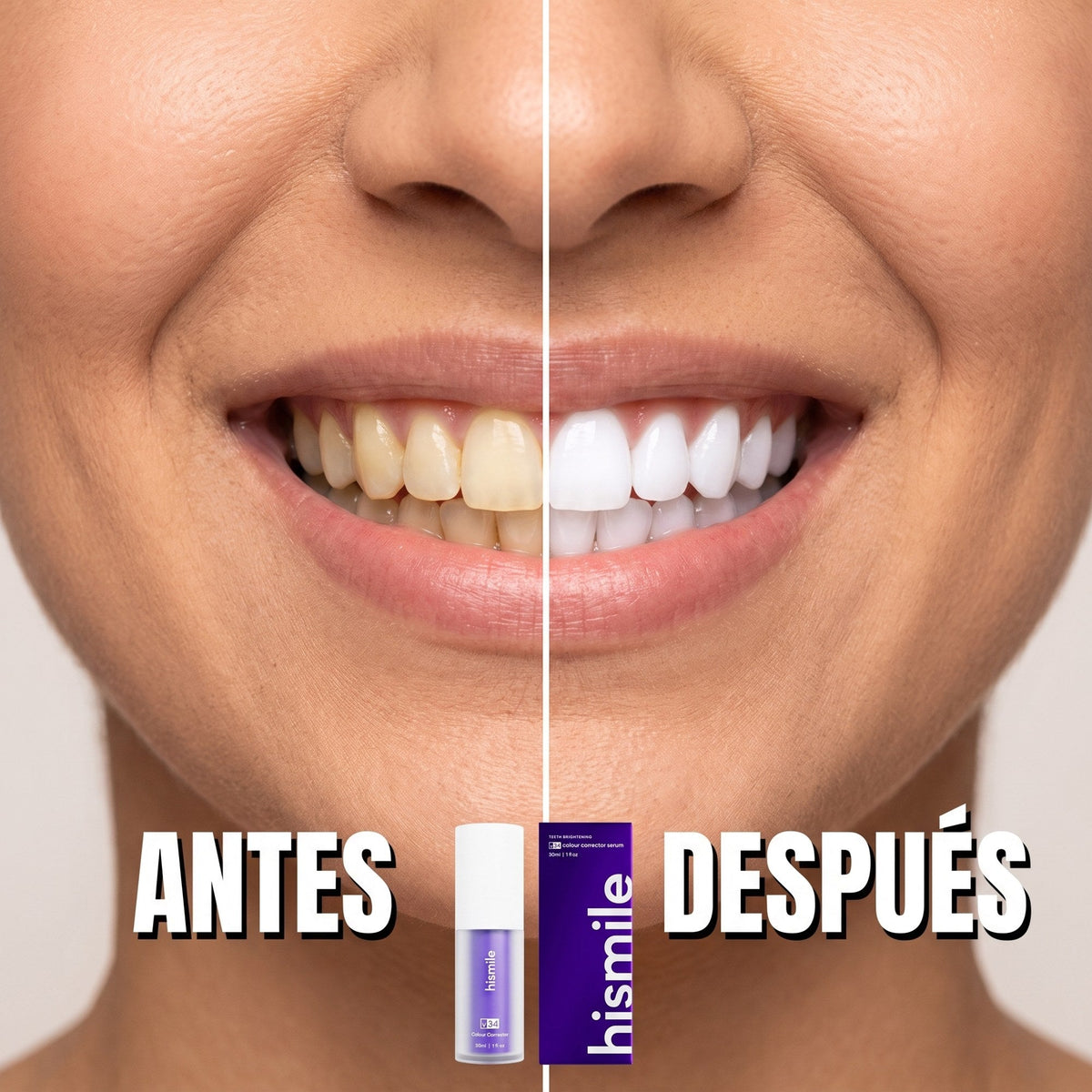 HiSmile V34 Colour Corrector — Sérum Morado Corrector de Color Dental (30 ml · Original)
