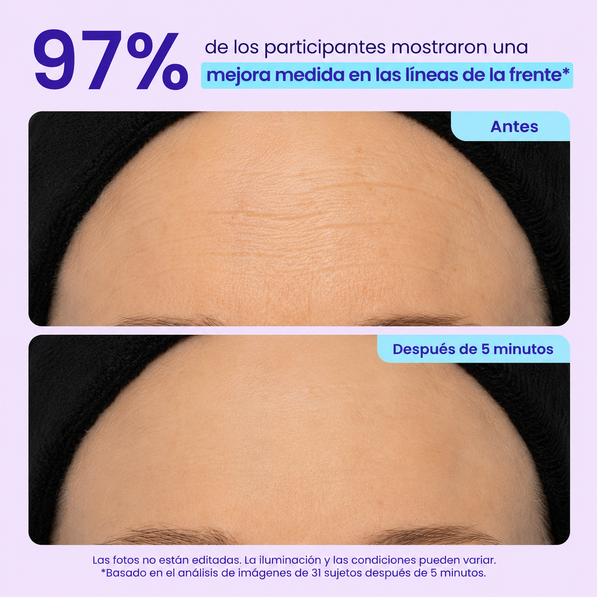 Gel de Ojos con Efecto Rejuvenecedor Instantáneo - #1 más viral en TikTok